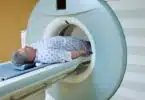 Radiothérapie pour le cancer de la prostate les effets secondaires et leur gestion