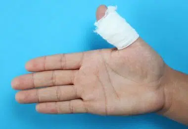Panaris quand devez vous consulter un docteur ou vous rendre aux urgences
