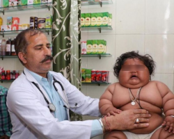 Inde : enfant obèse